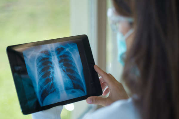 Tablette électronique montrant une radiographie des poumons