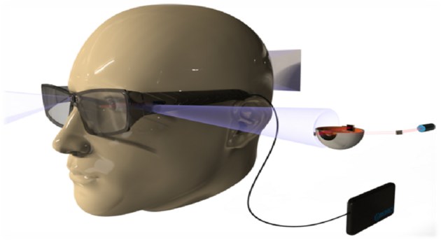 représentation du projet d'implant rétinien