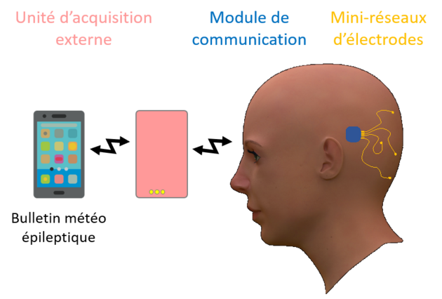 Vue globale du lien de communication de l'implant cortical