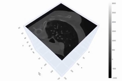 Photo du projet MEDimage