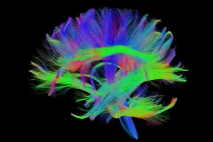 Photo du projet TractoML