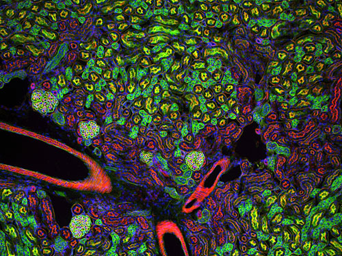 Cette photo d'une coupe de rein colore avec quatre fluorochomes permettra  Gilles Grondin, de la Facult des sciences, d'aller rcolter un prix lors du congrs de l'American Society for Cell Biology,  San Diego, en dcembre.