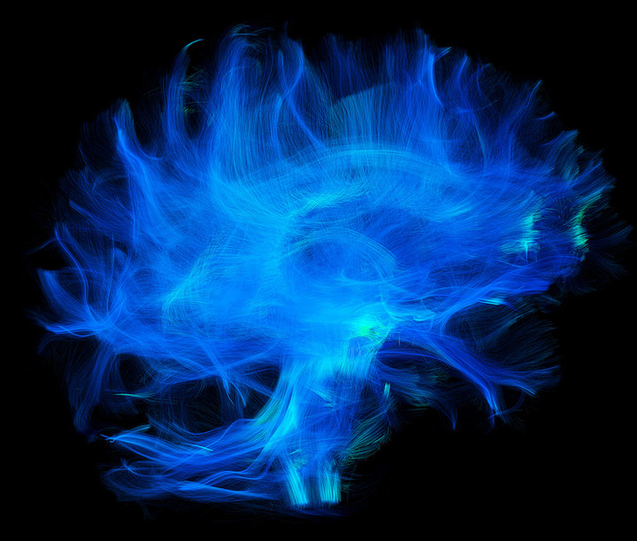 Autoroutes cérébrales, image primée au concours de l'ACFAS.