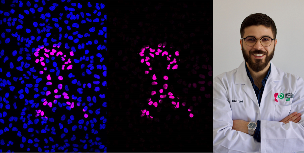 1er&nbsp;Prix : &laquo; Noyaux Roses d'Octobre &raquo;, Billel Djerir, doctorant dans le laboratoire d'Alexandre Mar&eacute;chal, professeur-chercheur &agrave; l'IRCUS au D&eacute;partement de biologie de la Facult&eacute; des sciences