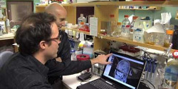 Des outils d'analyse d'images pour une neurochirurgie plus précise