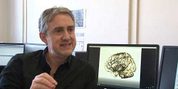 Des chercheurs de Sherbrooke documentent le premier atlas artériel et veineux du cerveau humain