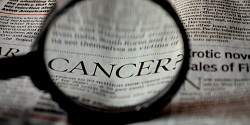 Une empreinte pour prédire la réponse des patients aux traitements anti-cancéreux