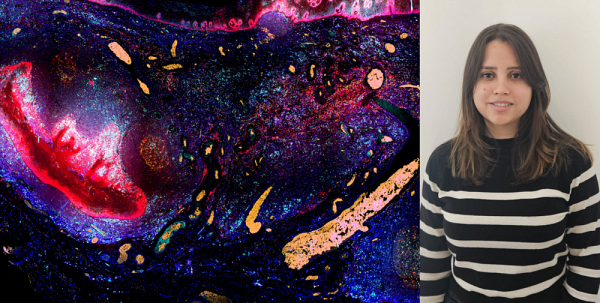 2e&nbsp;Prix :&nbsp;&laquo; Gen&egrave;se &raquo;, Celia del Carmen Crespo, &eacute;tudiante &agrave; la ma&icirc;trise dans le laboratoire d'Hugues Allard-Chamard (directeur) et de Marilyne Labrie (co-directrice), professeurs-chercheurs &agrave; l'IRCUS au d&eacute;partement d'immunologie et de biologie cellulaire de la Facult&eacute; de m&eacute;decine et des sciences de la sant&eacute;