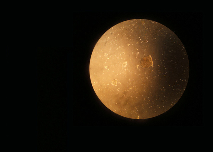 Pas de planète mais des milliers de cellules. Par erreur, l'objectif de l'appareil photo a été mal aligné avec l'oculaire du microscope, ce qui donne une apparence lunaire à cette culture de cellules cancéreuses. Cette image a été retenue par l'Acfas lors du concours en 2011.