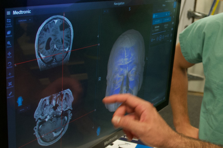 L’imagerie cérébrale de pointe permet d'explorer différentes pistes.