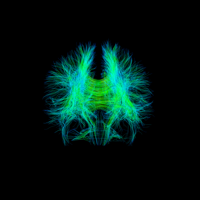 Cartographie par IRM de diffusion des autoroutes intracérébrales d'un cerveau humain.